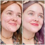 The Best Skincare Routine Based on Your Skin Type (Oily – Dry – Combination)