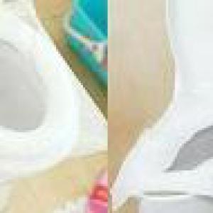 غطاء قاعدة تواليت بلاستيك مورا 15 قطعة (لاصق ذاتى) شفاف